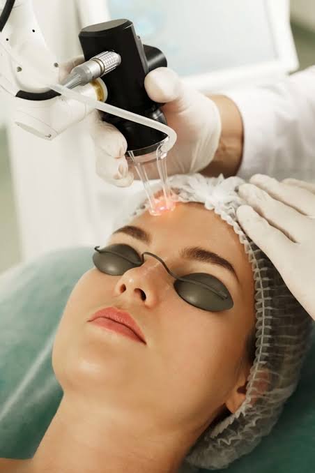 Fractional Laser